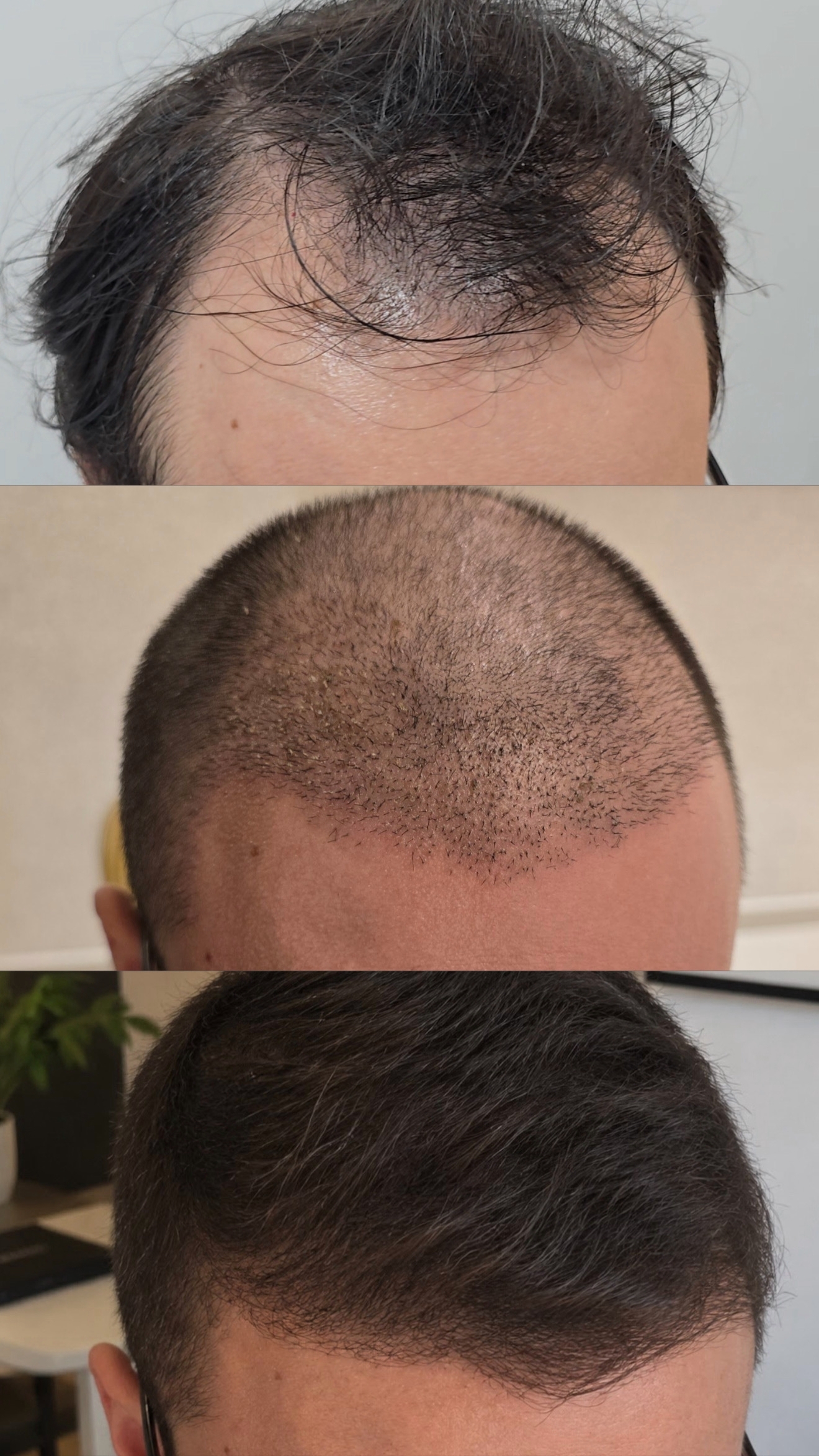 Imagem clínica comparativa de couro cabeludo